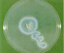 Fungal growths test